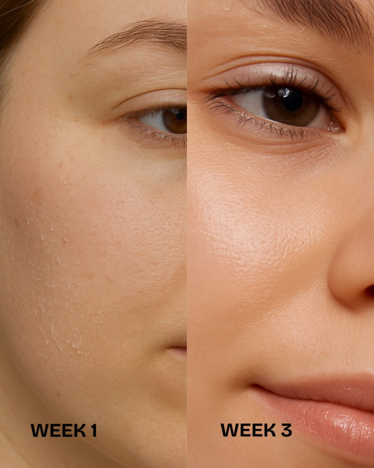 Before and after results using Rose Elixir face oil for radiant, healthy skin
