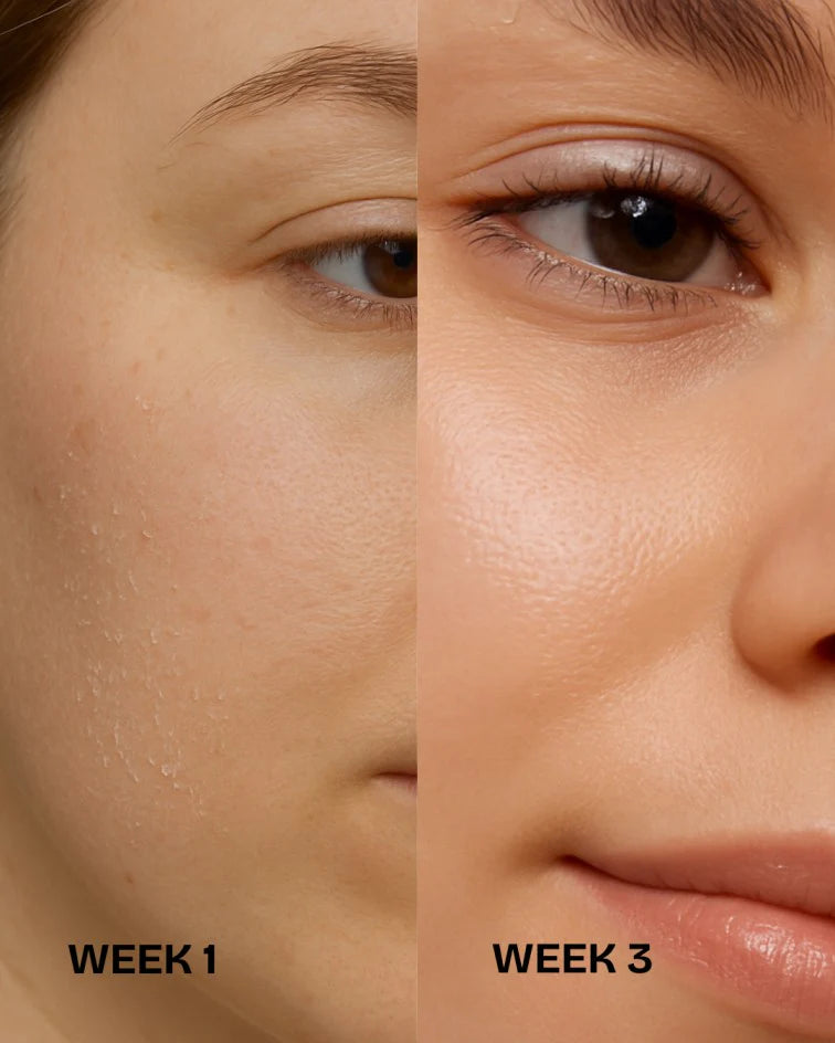 Rose Elixir Lightweight Face Oil for Dry Skin | Brightening & Barrier-Repair Oil